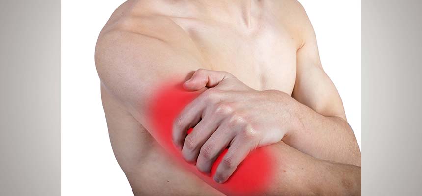 Patologia Contracturas musculares del brazo