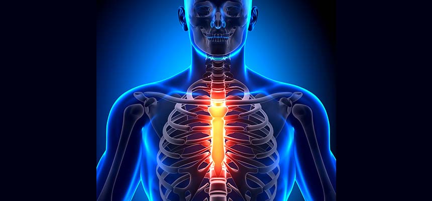 Patologia Dolor en el Esternón por Osteocondritis