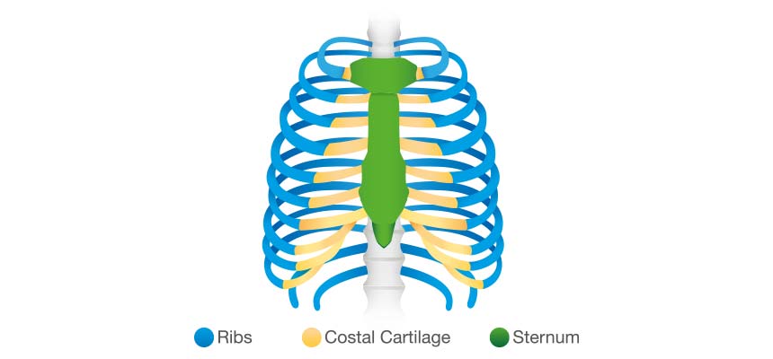 Patologia Fisuras y Fracturas costales