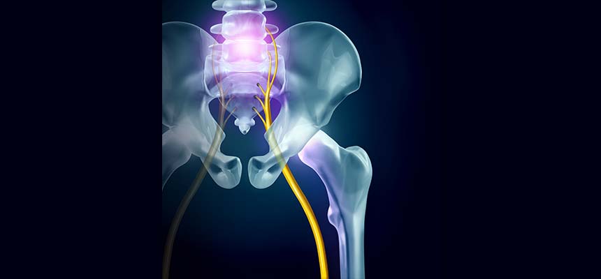 Patologia Hernias discales y Ciática