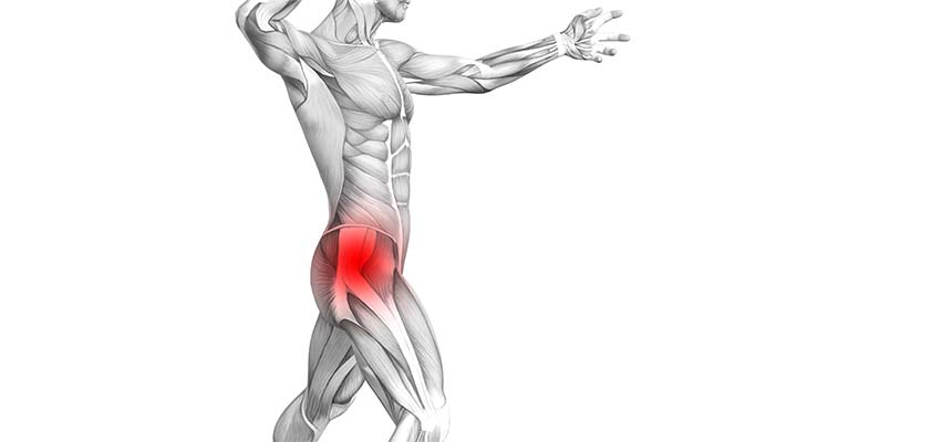 Patologia Trocanteritis o bursitis Trocantérea