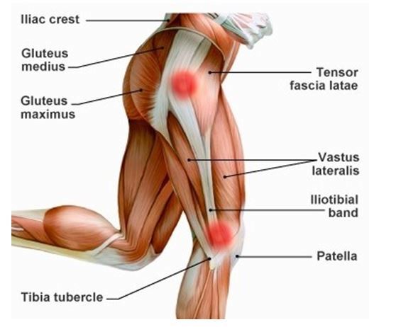 Síndrome del corredor - Clínica de Fisioterapia Avanzada Martín Vasco, Talavera