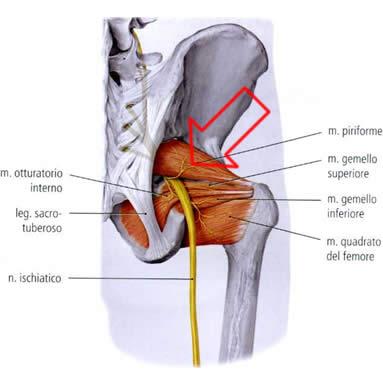 Síndrome del músculo piramidal - Clínica de Fisioterapia Avanzada Martín Vasco, Talavera